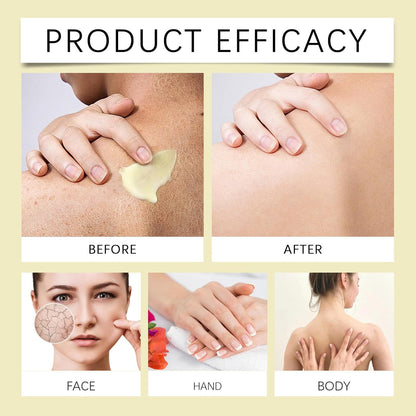 Beef Tallow Skincare, Beef Tallow Honey Balm, Natürlich Bodylotion Cream, Grass Fed Tallow Raw Wild Honey Zur Gesicht Und Körper Gepeitschte Feuchtigkeit