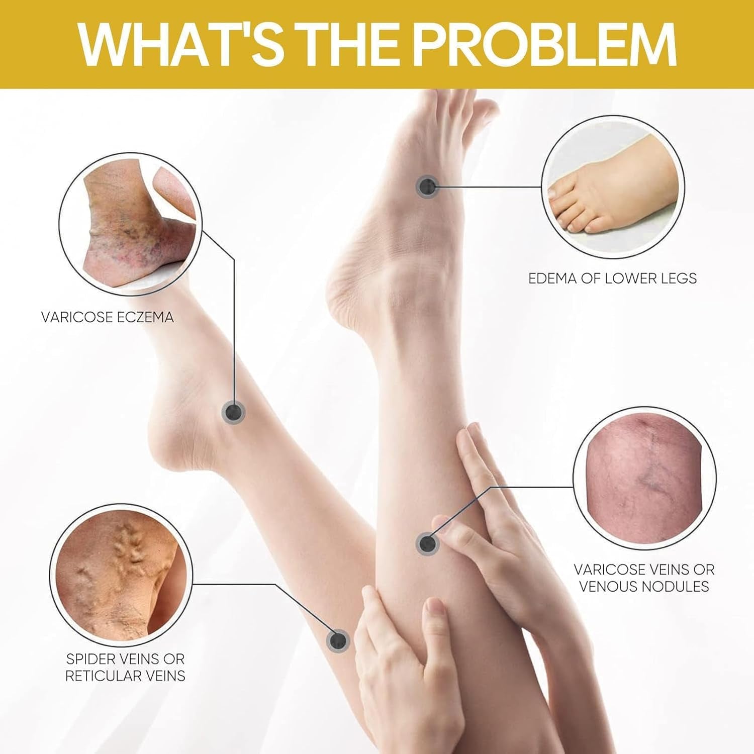 Furzero Bienengift Krampfadern Creme, Furzero Krampfadern Creme, Besenreiser Creme Testsieger, Bienengift Schmerzcreme Bienengiftsalbe, Bienengift Krampfadern Creme Für Jedermann (1 Stücke)